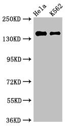 Western Blot Positive WB detected in: Hela whole cell lysate, K562 whole cell lysate All lanes: EEA1 antibody at 3microg/ml Secondary Goat polyclonal to rabbit IgG at 1/50000 dilution Predicted band size: 163 kDa Observed band size: 163 kDa