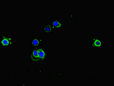 Immunofluorescent analysis of Hela cells using CSB-PA007409LA01HU at dilution of 1:100 and Alexa Fluor 488-congugated AffiniPure Goat Anti-Rabbit IgG(H+L)