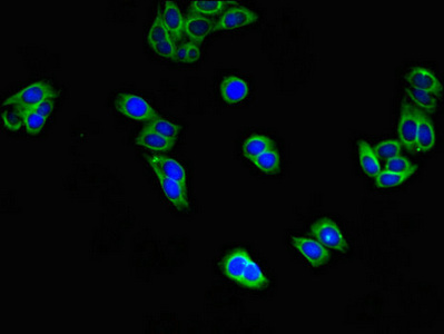 Immunofluorescent analysis of HepG2 cells using CSB-PA007556LA01HU at dilution of 1:100 and Alexa Fluor 488-congugated AffiniPure Goat Anti-Rabbit IgG(H+L)