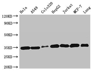 Western Blot Positive WB detected in: Hela whole cell lysate, A549 whole cell lysate, Colo320 whole cell lysate, HepG2 whole cell lysate, Jurkat whole cell lysate, MCF-7 whole cell lysate, Mouse lung tissue All lanes: EMD antibody at 2microg/ml Secondary Goat polyclonal to rabbit IgG at 1/50000 dilution Predicted band size: 29 kDa Observed band size: 35 kDa