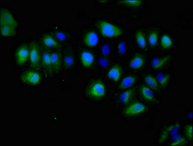 Immunofluorescence(IF) - EPHA5 Antibody