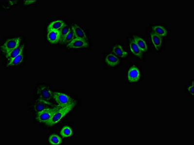 Immunofluorescence(IF) - ERBB4 Antibody