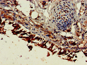 Immunohistochemistry of paraffin-embedded human lung tissue using CSB-PA007825HA01HU at dilution of 1:100 Immunohistochemistry of paraffin-embedded human lung tissue using CSB-PA007825HA01HU at dilution of 1:100
