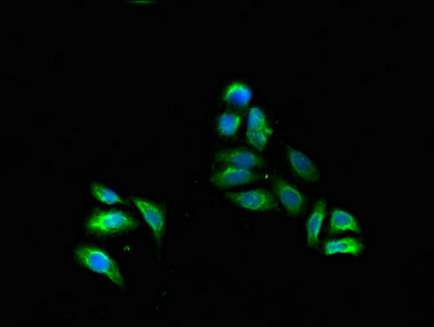 Immunofluorescent analysis of HepG2 cells using CSB-PA007959LA01HU at dilution of 1:100 and Alexa Fluor 488-congugated AffiniPure Goat Anti-Rabbit IgG(H+L)