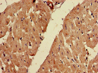 Immunohistochemistry of paraffin-embedded human heart tissue using CSB-PA007959LA01HU at dilution of 1:100