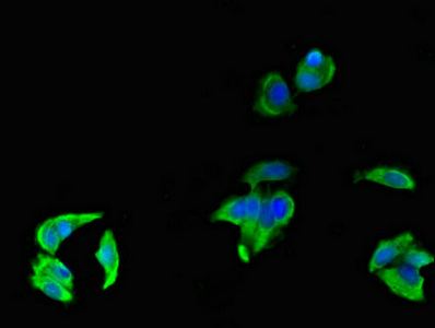 Immunofluorescence(IF) - FCGR3A Antibody