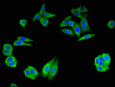 Immunofluorescent analysis of HepG2 cells using CSB-PA009322LA01HU at dilution of 1:100 and Alexa Fluor 488-congugated AffiniPure Goat Anti-Rabbit IgG(H+L)