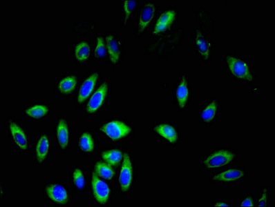 Immunofluorescent analysis of A549 cells using CSB-PA009690LA01HU at dilution of 1:100 and Alexa Fluor 488-congugated AffiniPure Goat Anti-Rabbit IgG(H+L)
