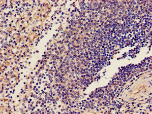 Immunohistochemistry of paraffin-embedded human spleen tissue using CSB-PA009690LA01HU at dilution of 1:100