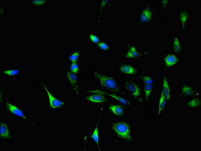 Immunofluorescent analysis of Hela cells using CSB-PA009982LA01HU at dilution of 1:100 and Alexa Fluor 488-congugated AffiniPure Goat Anti-Rabbit IgG(H+L)