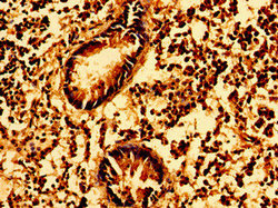 Immunohistochemistry of paraffin-embedded human appendix tissue using CSB-PA009995LA01HU at dilution of 1:100 Immunohistochemistry of paraffin-embedded human appendix tissue using CSB-PA009995LA01HU at dilution of 1:100