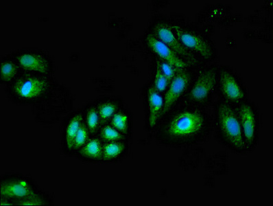 Immunofluorescent analysis of HepG2 cells using CSB-PA010084LA01HU at dilution of 1:100 and Alexa Fluor 488-congugated AffiniPure Goat Anti-Rabbit IgG(H+L)