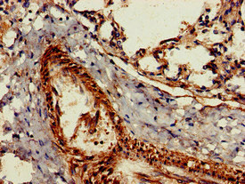 Immunohistochemistry of paraffin-embedded human lung tissue using CSB-PA010084LA01HU at dilution of 1:100 Immunohistochemistry of paraffin-embedded human lung tissue using CSB-PA010084LA01HU at dilution of 1:100