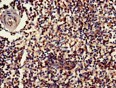 Immunohistochemistry of paraffin-embedded human spleen tissue using CSB-PA010084LA01HU at dilution of 1:100
