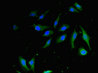 Immunofluorescence(IF) - HMGB1 Antibody