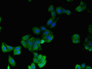 Immunofluorescent analysis of HepG2 cells using CSB-PA010702LA01HU at dilution of 1:100 and Alexa Fluor 488-congugated AffiniPure Goat Anti-Rabbit IgG(H+L)