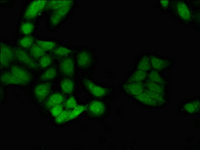 Immunofluorescent analysis of Hela cells using CSB-PA010970LA01HU at dilution of 1:100 and Alexa Fluor 488-congugated AffiniPure Goat Anti-Rabbit IgG(H+L)
