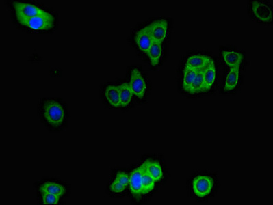 Immunofluorescent analysis of HepG2 cells using CSB-PA010988LA01HU at dilution of 1:100 and Alexa Fluor 488-congugated AffiniPure Goat Anti-Rabbit IgG(H+L)