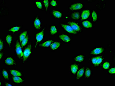 Immunofluorescent analysis of A549 cells using CSB-PA010991LA01HU at dilution of 1:100 and Alexa Fluor 488-congugated AffiniPure Goat Anti-Rabbit IgG(H+L)