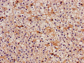 Immunohistochemistry of paraffin-embedded human adrenal gland tissue using CSB-PA010991LA01HU at dilution of 1:100