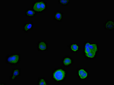 Immunofluorescent analysis of MCF-7 cells using CSB-PA011002LA01HU at dilution of 1:100 and Alexa Fluor 488-congugated AffiniPure Goat Anti-Rabbit IgG(H+L) Immunofluorescent analysis of MCF-7 cells using CSB-PA011002LA01HU at dilution of 1:100 and Alexa Fluor 488-congugated AffiniPure Goat Anti-Rabbit IgG(H+L)