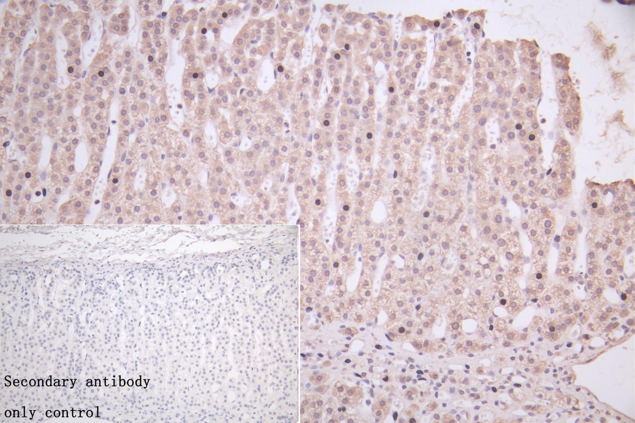 IHC image of CSB-PA011018LA01HU diluted at 1:50 and staining in paraffin-embedded human adrenal gland tissue performed on a Leica BondTM system. After dewaxing and hydration, antigen retrieval was mediated by high pressure in a citrate buffer (pH 6.0). Section was blocked with 10% normal goat serum 30min at RT. Then primary antibody (1% BSA) was incubated at 4°C overnight. The primary is detected by a Goat anti-rabbit polymer IgG labeled by HRP and visualized using 0.05% DAB.Secondary antibody only control: uses 1% BSA instead of primary antibody. IHC image of CSB-PA011018LA01HU diluted at 1:50 and staining in paraffin-embedded human adrenal gland tissue performed on a Leica BondTM system. After dewaxing and hydration, antigen retrieval was mediated by high pressure in a citrate buffer (pH 6.0). Section was blocked with 10% normal goat serum 30min at RT. Then primary antibody (1% BSA) was incubated at 4°C overnight. The primary is detected by a Goat anti-rabbit polymer IgG labeled by HRP and visualized using 0.05% DAB.Secondary antibody only control: uses 1% BSA instead of primary antibody.