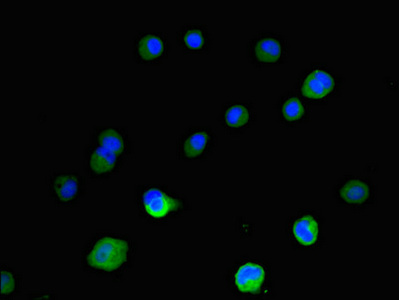 Immunofluorescence(IF) - IGF2BP3 Antibody