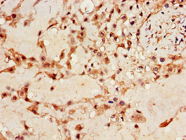 CSB-PA011092LA01HU IHC-1