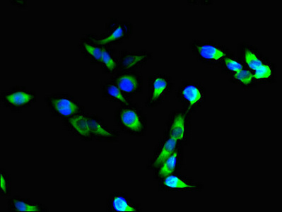 Immunofluorescence(IF) - ITGAM Antibody