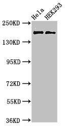 Western Blot Positive WB detected in: Hela whole cell lysate, HEK293 whole cell lysate All lanes: KIDINS220 antibody at 3microg/ml Secondary Goat polyclonal to rabbit IgG at 1/50000 dilution Predicted band size: 197, 186, 116, 195, 60 kDa Observed band size: 197 kDa