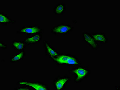 Immunofluorescent analysis of Hela cells using CSB-PA013427LA01HU at dilution of 1:100 and Alexa Fluor 488-congugated AffiniPure Goat Anti-Rabbit IgG(H+L)
