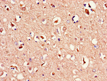 Immunohistochemistry of paraffin-embedded human brain tissue using CSB-PA013449LA01HU at dilution of 1:100 Immunohistochemistry of paraffin-embedded human brain tissue using CSB-PA013449LA01HU at dilution of 1:100