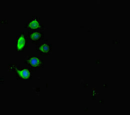 Immunofluorescent analysis of A549 cells using CSB-PA014755LA01HU at dilution of 1:100 and Alexa Fluor 488-congugated AffiniPure Goat Anti-Rabbit IgG(H+L)