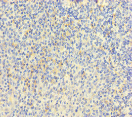 Immunohistochemistry of paraffin-embedded human tonsil tissue using CSB-PA014755LA01HU at dilution of 1:100 Immunohistochemistry of paraffin-embedded human tonsil tissue using CSB-PA014755LA01HU at dilution of 1:100