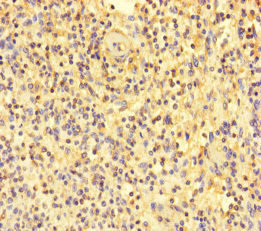 Immunohistochemistry of paraffin-embedded human spleen tissue using CSB-PA014755LA01HU at dilution of 1:100