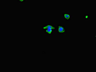 Immunofluorescent analysis of HepG2 cells using CSB-PA015297LA01HU at dilution of 1:100 and Alexa Fluor 488-congugated AffiniPure Goat Anti-Rabbit IgG(H+L)