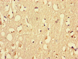 Immunohistochemistry of paraffin-embedded human brain tissue using CSB-PA015297LA01HU at dilution of 1:100 Immunohistochemistry of paraffin-embedded human brain tissue using CSB-PA015297LA01HU at dilution of 1:100