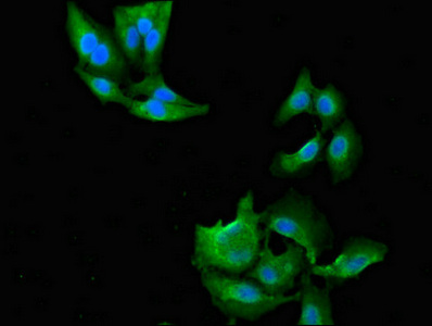 Immunofluorescent analysis of Hela cells using CSB-PA015464LA01HU at dilution of 1:100 and Alexa Fluor 488-congugated AffiniPure Goat Anti-Rabbit IgG(H+L)