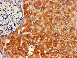 Immunohistochemistry of paraffin-embedded human liver tissue using CSB-PA015464LA01HU at dilution of 1:100