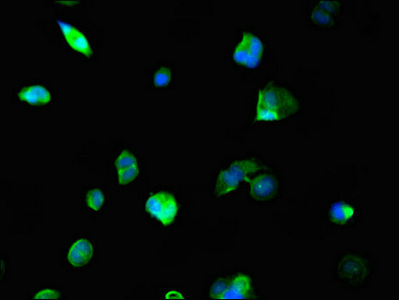Immunofluorescent analysis of MCF-7 cells using CSB-PA015544LA01HU at dilution of 1:100 and Alexa Fluor 488-congugated AffiniPure Goat Anti-Rabbit IgG(H+L)