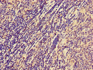 Immunohistochemistry of paraffin-embedded human lymph node tissue using CSB-PA015549LA01HU at dilution of 1:100 Immunohistochemistry of paraffin-embedded human lymph node tissue using CSB-PA015549LA01HU at dilution of 1:100