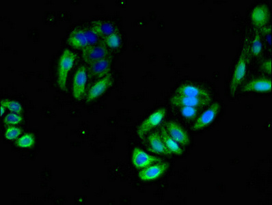 Immunofluorescence(IF) - NRAS Antibody
