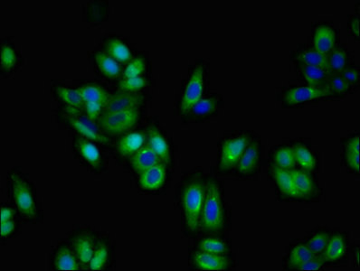 Immunofluorescent analysis of HepG2 cells using CSB-PA016133LA01HU at dilution of 1:100 and Alexa Fluor 488-congugated AffiniPure Goat Anti-Rabbit IgG(H+L)