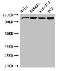 Western Blot Positive WB detected in: Hela whole cell lysate, HEK293 whole cell lysate, NIH/3T3 whole cell lysate, PC-3 whole cell lysate All lanes: NUP107 antibody at 3.4microg/ml Secondary Goat polyclonal to rabbit IgG at 1/50000 dilution Predicted band size: 107, 104, 80 kDa Observed band size: 107 kDa Western Blot Positive WB detected in: Hela whole cell lysate, HEK293 whole cell lysate, NIH/3T3 whole cell lysate, PC-3 whole cell lysate All lanes: NUP107 antibody at 3.4microg/ml Secondary Goat polyclonal to rabbit IgG at 1/50000 dilution Predicted band size: 107, 104, 80 kDa Observed band size: 107 kDa
