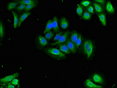 Immunofluorescent analysis of HepG2 cells using CSB-PA017315LA01HU at dilution of 1:100 and Alexa Fluor 488-congugated AffiniPure Goat Anti-Rabbit IgG(H+L)