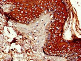 Immunohistochemistry of paraffin-embedded human skin tissue using CSB-PA017339LA01HU at dilution of 1:100