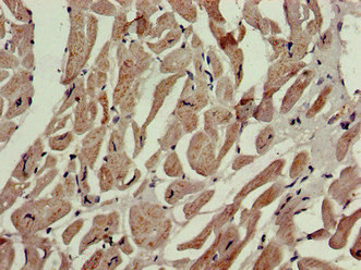 Immunohistochemistry of paraffin-embedded human heart tissue using CSB-PA017339LA01HU at dilution of 1:100