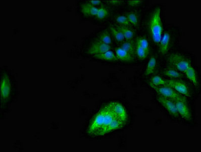Immunofluorescent analysis of Hela cells using CSB-PA017788LA01HU at dilution of 1:100 and Alexa Fluor 488-congugated AffiniPure Goat Anti-Rabbit IgG(H+L)