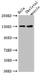 Western Blot Positive WB detected in: Hela whole cell lysate, Mouse skeletal muscle tissue All lanes: PER3 antibody at 4microg/ml Secondary Goat polyclonal to rabbit IgG at 1/50000 dilution Predicted band size: 132, 133 kDa Observed band size: 132 kDa Western Blot Positive WB detected in: Hela whole cell lysate, Mouse skeletal muscle tissue All lanes: PER3 antibody at 4microg/ml Secondary Goat polyclonal to rabbit IgG at 1/50000 dilution Predicted band size: 132, 133 kDa Observed band size: 132 kDa