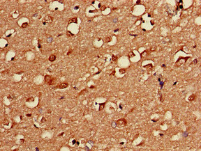 Immunohistochemistry of paraffin-embedded human brain tissue using CSB-PA018689LA01HU at dilution of 1:100 Immunohistochemistry of paraffin-embedded human brain tissue using CSB-PA018689LA01HU at dilution of 1:100